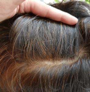 My Blogs: Bee Choo Origin Herbal Hair Treatment