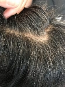 Here Is The Best Way To Cover Your White Hairs Naturally - Bee Choo Ladies